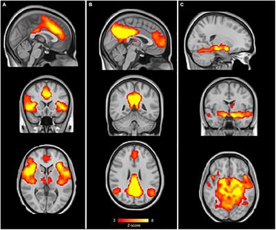 Resting-State Functional Connectivity Characteristics of Resilience to Traumatic Stress in Dutch Police Officers